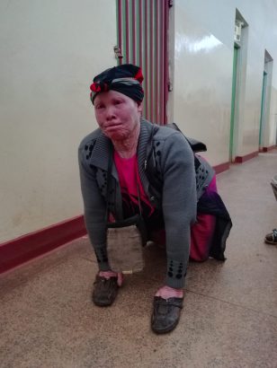 Josphine auf allen Vieren im Wartebereich, Krankenhaus von Keumbu